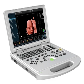 4D 5D Lékařské ultrazvukové přístroje pro notebook kliniky nemocnice přenosné barevné dopplerovské ultrazvukové ecografo portatil